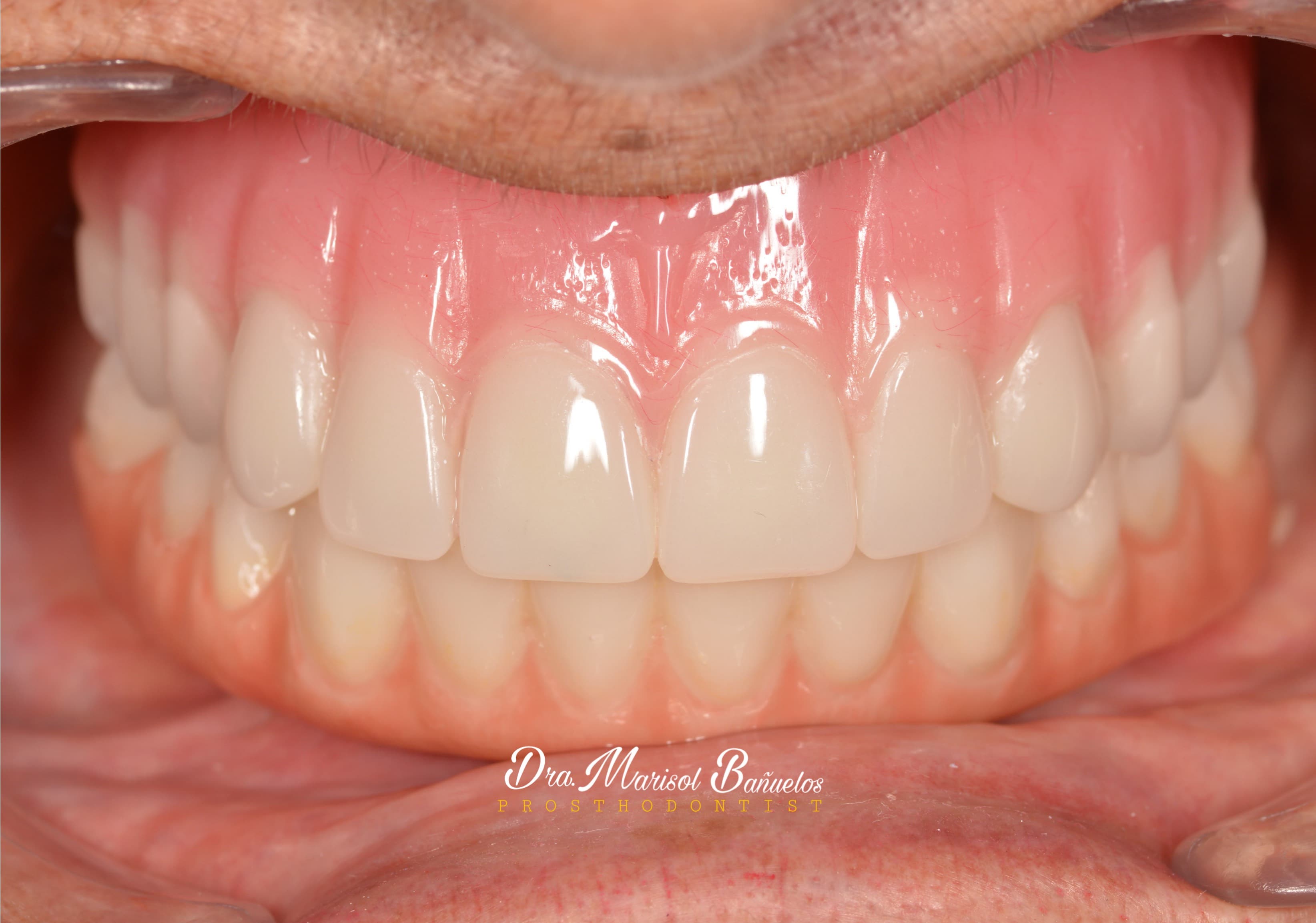 Periodoncia e implantologia.