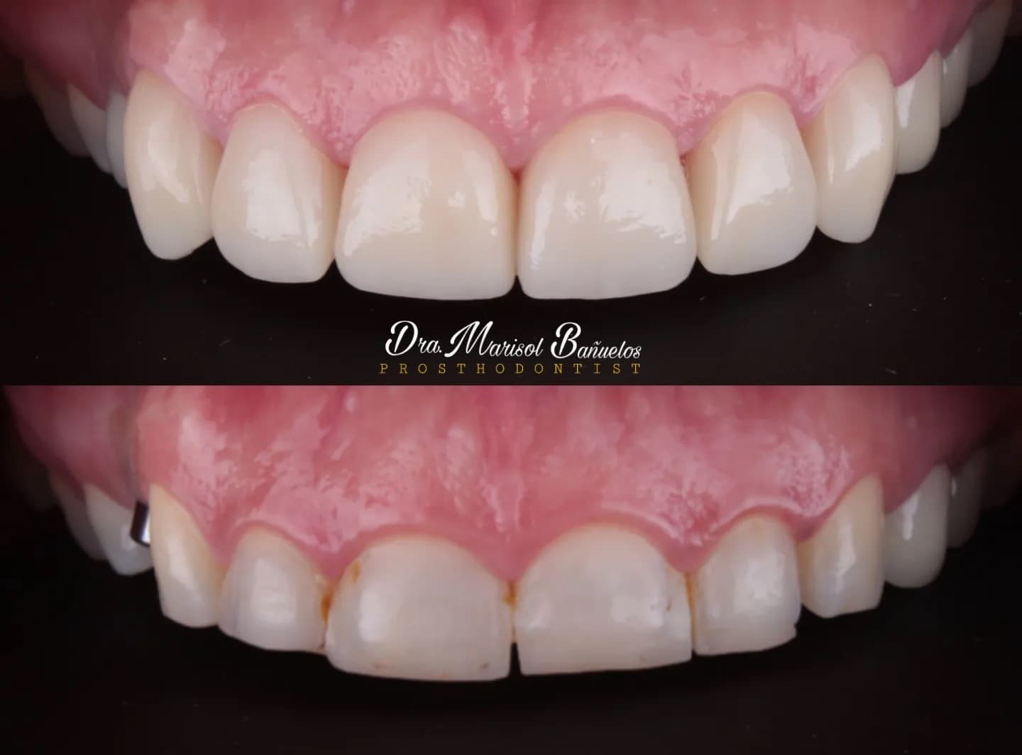 Odontologia estética, restauradora, implantologia.